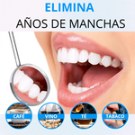 LÁPIZ BLANQUEADOR DE DIENTES – Elimina Manchas y Blanquea tu Sonrisa en Días | SMILE WHITE™