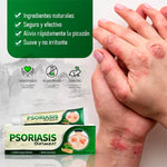 Crema Antifúngica y Antipicazón – Tratamiento Natural para Tiña, Hongos y Psoriasis | 20g