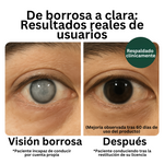 Zoone™ Visión Plus - Recuperación Visual