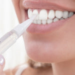 LÁPIZ BLANQUEADOR DE DIENTES – Elimina Manchas y Blanquea tu Sonrisa en Días | SMILE WHITE™